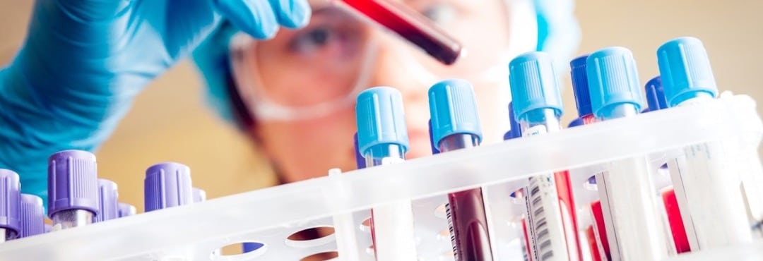 چه مدت طول می کشد تا برای آزمایش خون آماده شوید؟