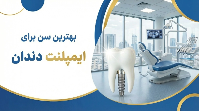 في أي عمر يتم إجراء زراعة الأسنان؟ ✔ أفضل عمر للزراعة