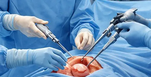 What is a hysterectomy? Types, uses, complications and post-operative care