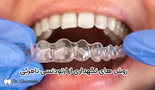 Maintenance of invisible orthodontics