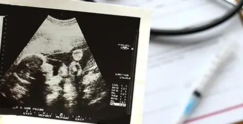 In vitro fertilization (IVF) complete and specialized explanation