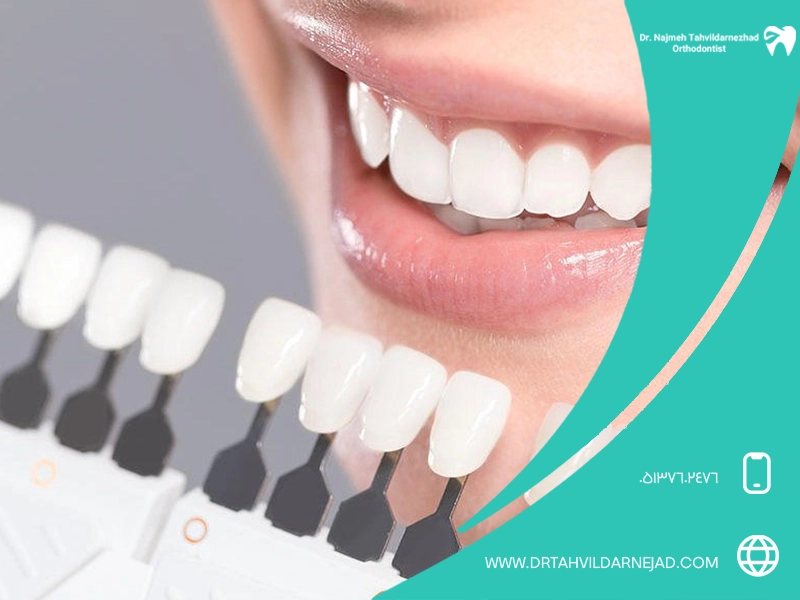 Composite, laminate or coating? How to make the best choice?