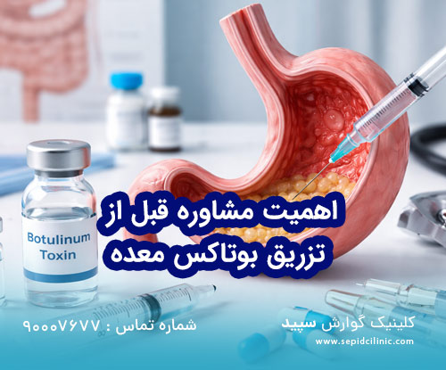 اهمیت مشاوره قبل از تزریق بوتاکس معده + چه نکاتی را باید بدانید؟