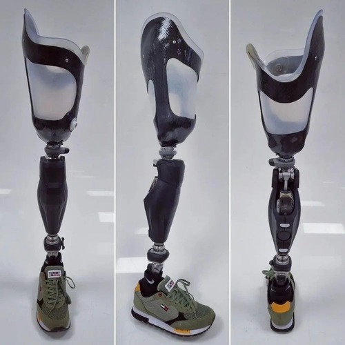 How to mold a patient's foot to make an artificial foot