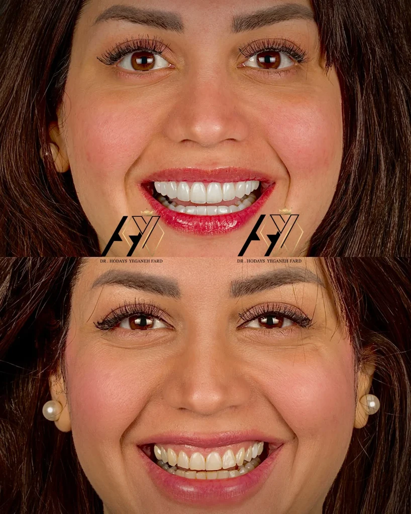 بهترین کلینیک دندانپزشکی پاسداران تهران 1404| ایمپلنت و زیبایی دندان در Tdenta