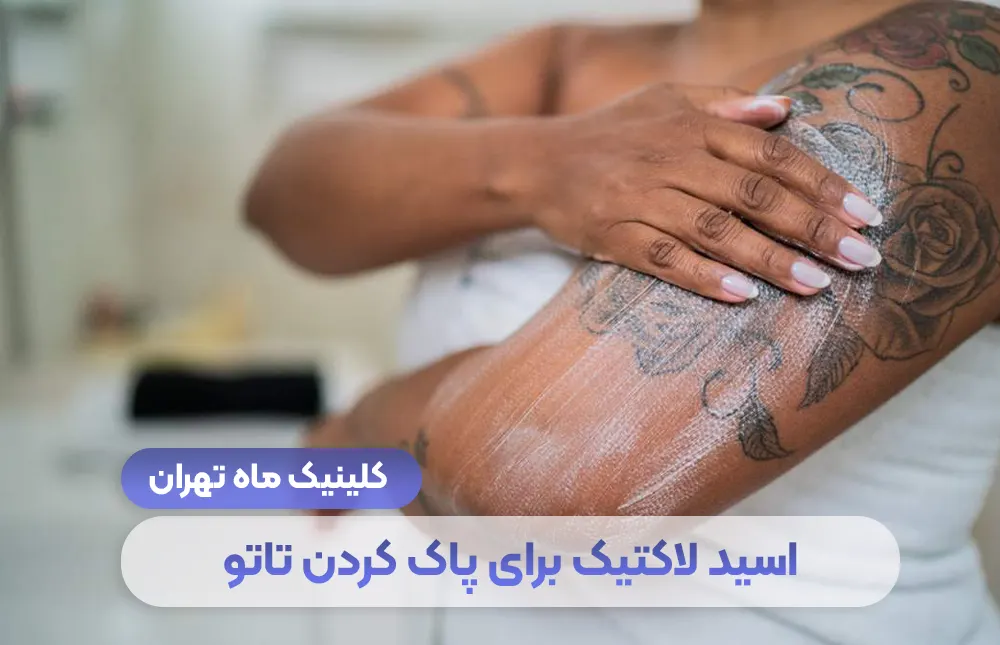 حمض اللاكتيك لإزالة الوشم السطحي - Mah Clinic طهران