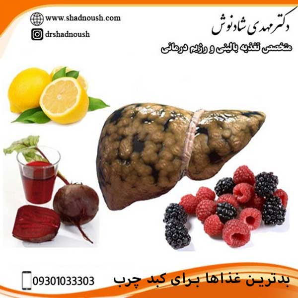 بدترین غذاها برای کبد چرب اشتباهات رایج غذایی ایرانیان دکتر مهدی شادنوش