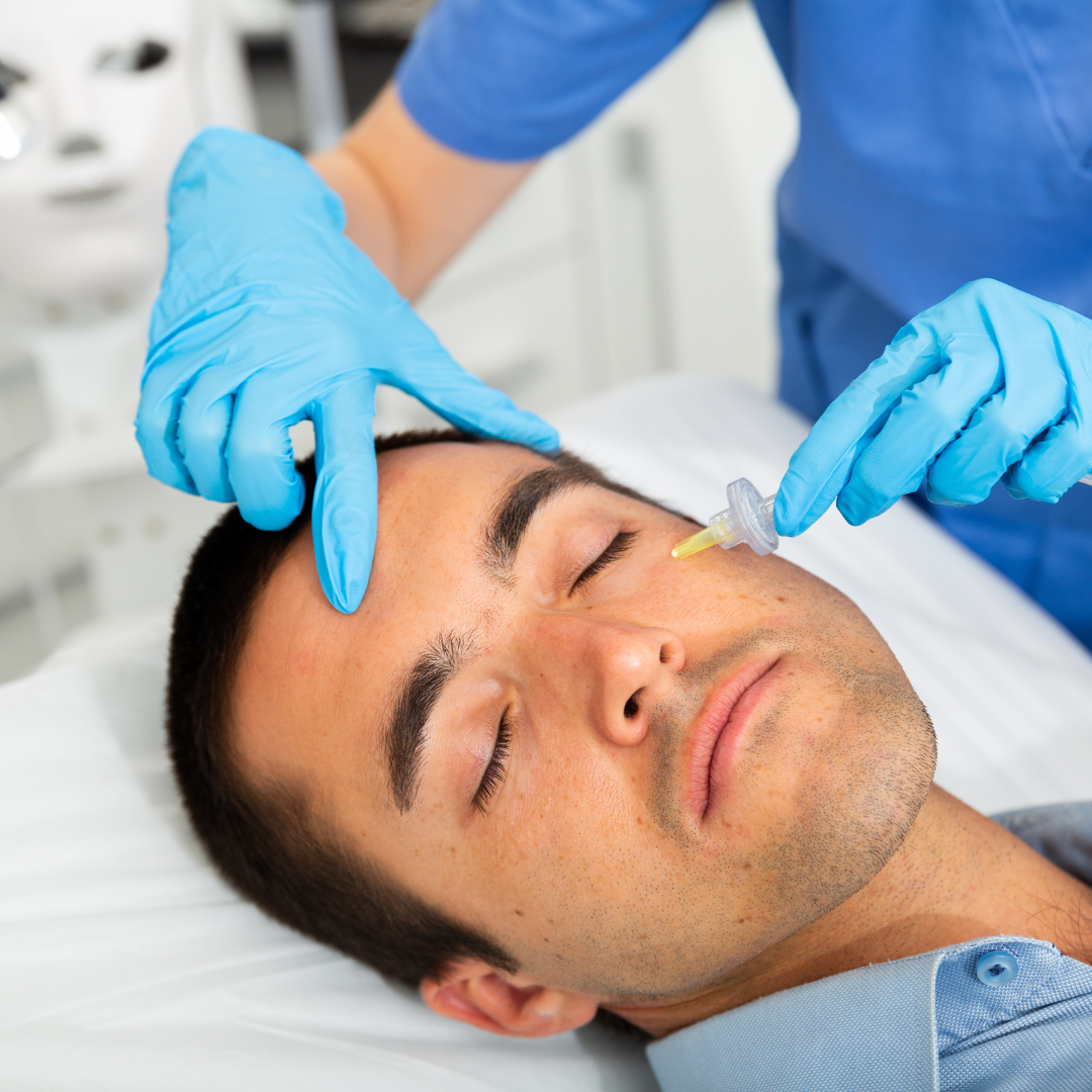 Removing darkness and dark circles around the eyes with carboxytherapy in Gorgan - Dr. Mehrdad Timourian, skin, hair and beauty specialist