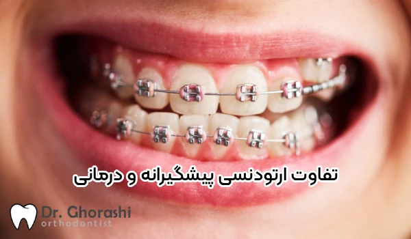 تفاوت ارتودنسی پیشگیرانه و درمانی چیست؟