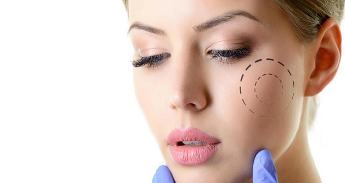 The best cheek surgeon in North Tehran