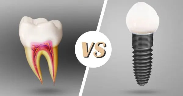 Is implant better or nerve removal? Comparing the amount of pain, durability