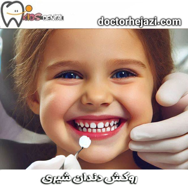 Baby tooth crown ✔ Dr. Mandana Hejazi