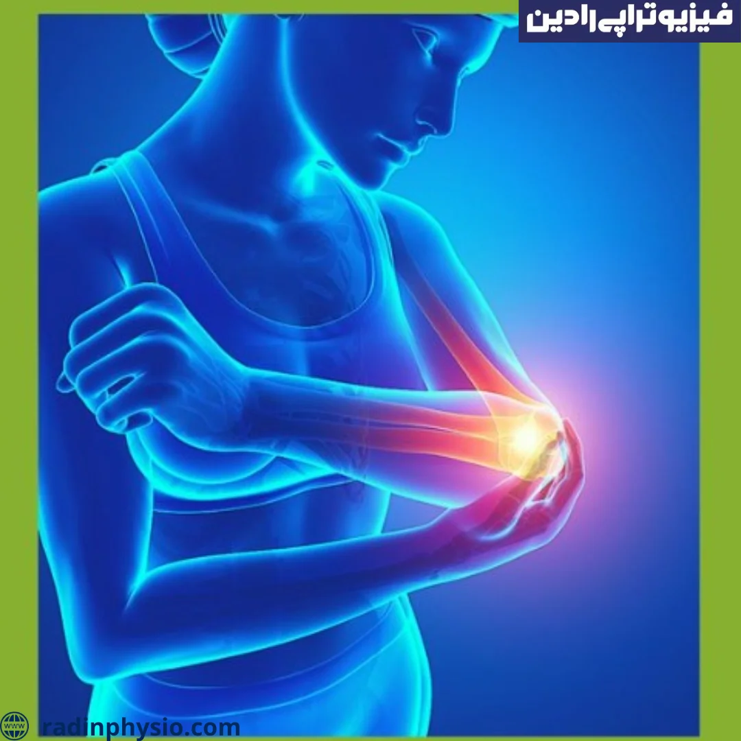 تورم پشت آرنج یا بورسیت اولکرانون چیست؟ کلینیک فیزیوتراپی رادین