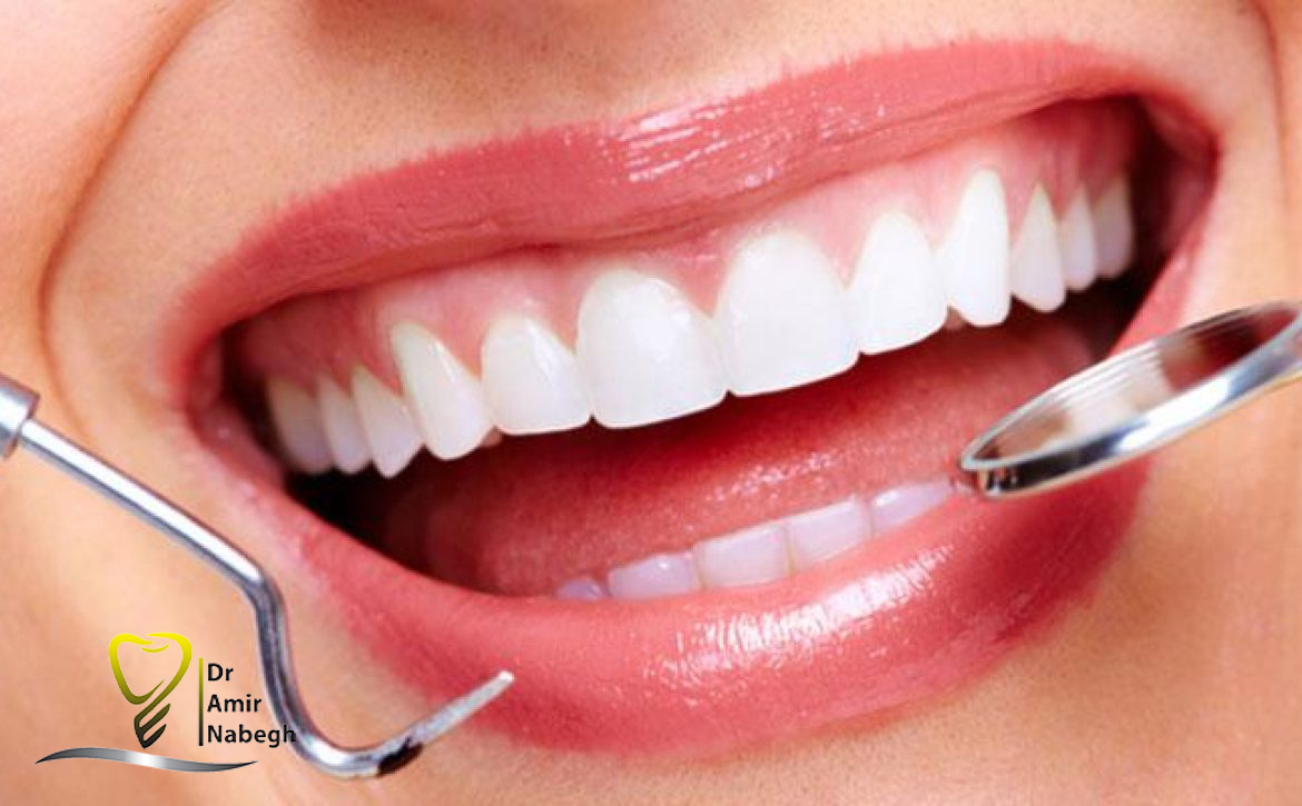 الترميمات التجميلية للأسنان