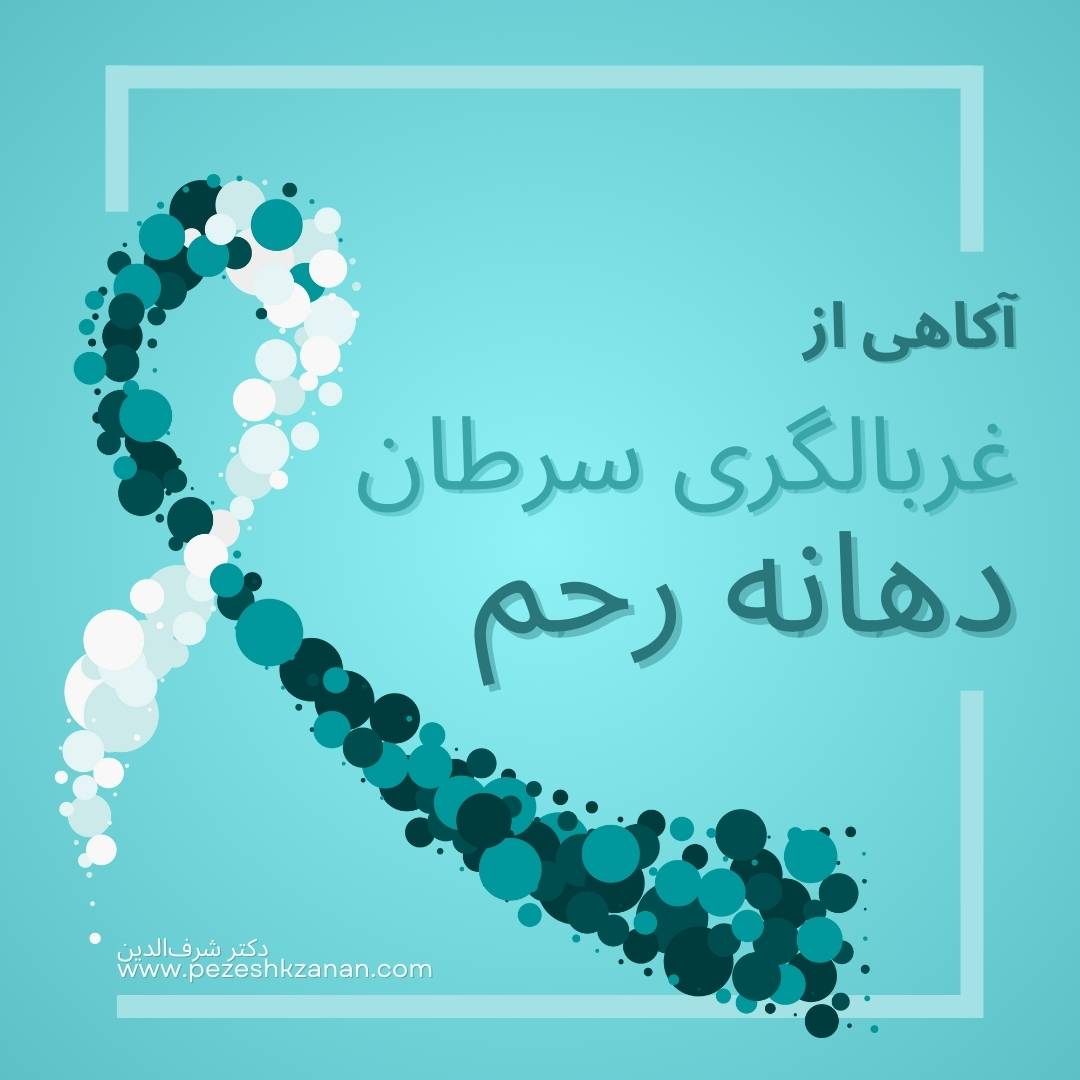 فحص سرطان عنق الرحم - د. شرف الدين - طبيب نسائي، رشت