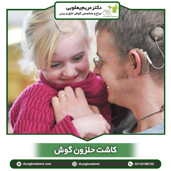 Cochlear implantation + why and how to do it + care tips by Dr. Maryam Yaqoubi