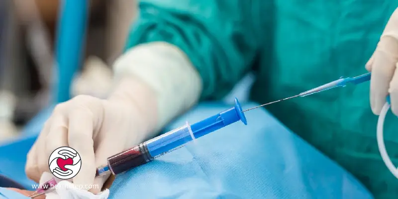 When is heart echocardiography recommended - Dr. Hekmat