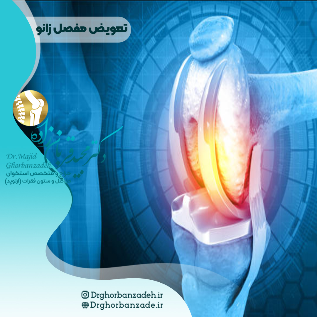 عوارض تعویض مفصل زانو - 3 نکته کلیدی دکتر مجید قربان زاده