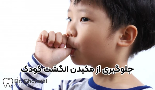 پیشگیری از مکیدن انگشت کودک - دکتر قریشی