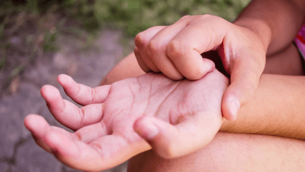 سبب حكة اليدين