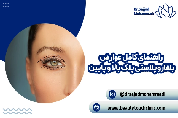 راهنمای کامل عوارض بلفاروپلاستی پلک بالا و پایین (از عوارض شایع تا نادر)