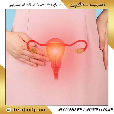 اواریکتومی: دلایل، عوارض و مراقبت های بعد از عمل