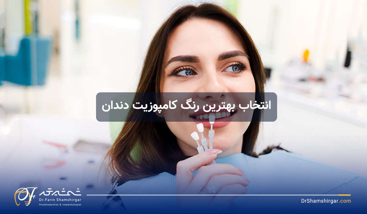 Dental composite color and choosing the best dental composite color