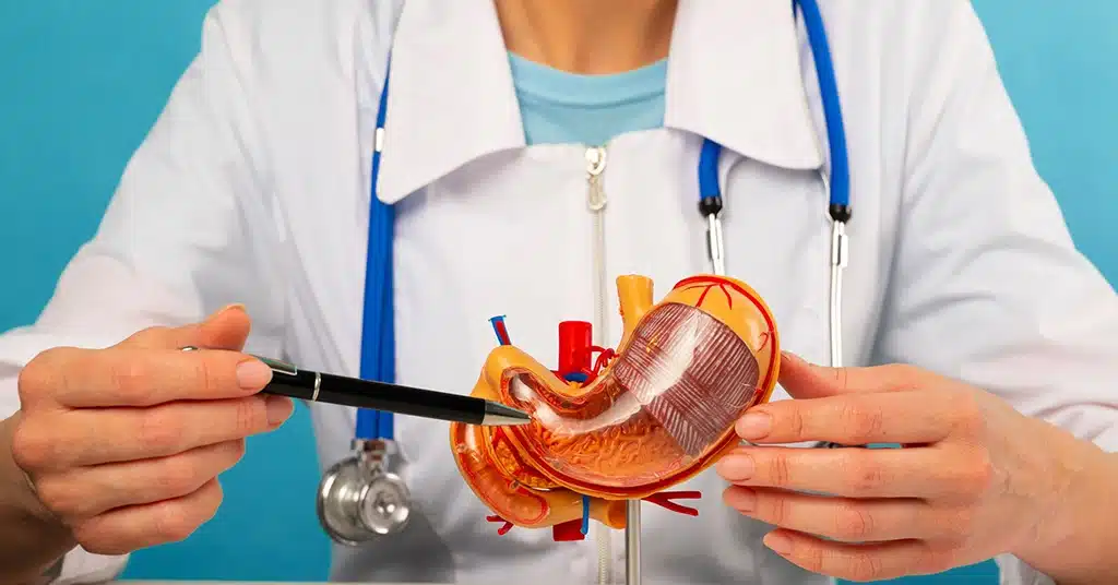 أرخص عملية فقدان الوزن