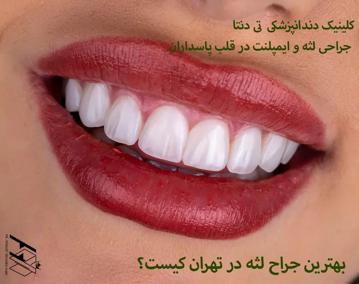 بهترین جراح لثه در کلینیک دندانپزشکی تهران تی دنتا