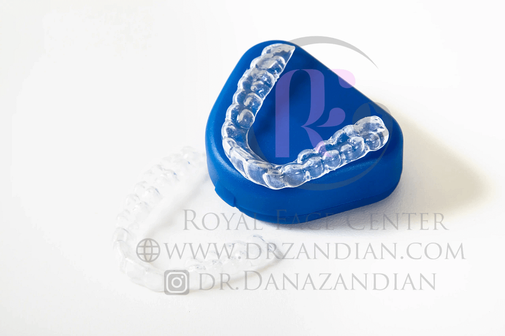 كيفية استخدام التجنيب تقويم الأسنان؟ يتعلم أكثر! - د.دانا زنديان