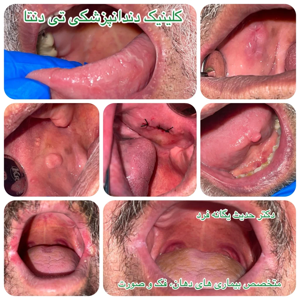 بهترین متخصص بیماری های دهان و فک و صورت در تهران پاسداران تشخیص ضایعات در کلینیک تدنتا - کلینیک دندانپزشکی تدنتا دکتر علیرضا تسلیمی و دکتر حدیث یگانه فرد