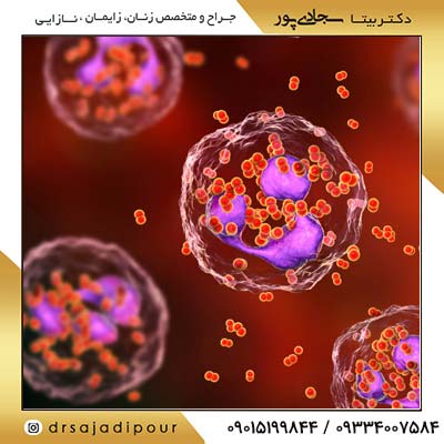 سوزاک: چگونه تشخیص داده می شود و چه درمان هایی موثر است؟