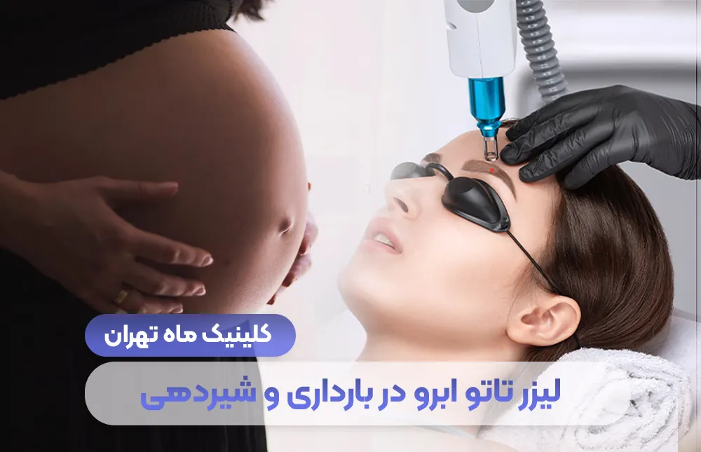 هل وشم الحواجب بالليزر ممكن أثناء الحمل والرضاعة؟ - عيادة طهران ماه