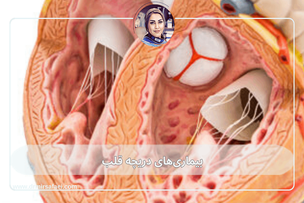 بیماری های دریچه قلب: علائم