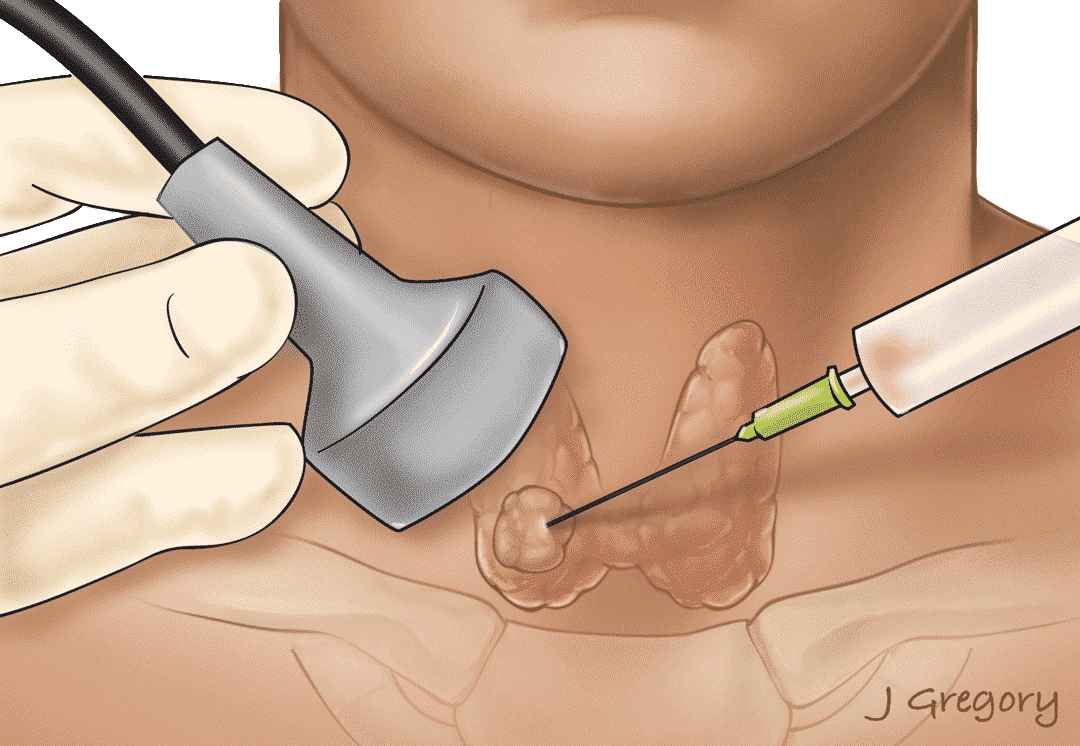 الدكتور صابر سادات أميني، أخصائي الغدة الدرقية والسكري في طهران