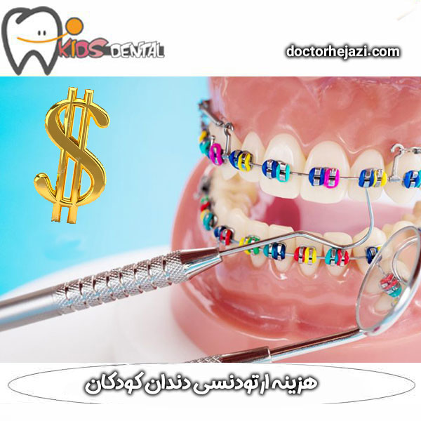 The cost of orthodontics of children's teeth in 1404 | Dr. Mandana Hejazi
