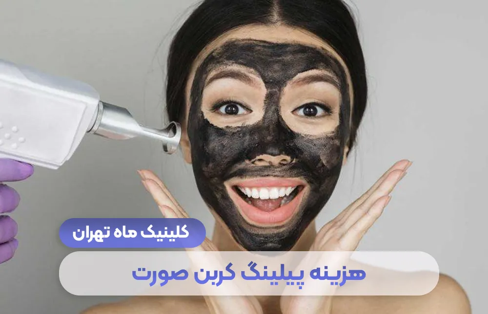 قائمة تكلفة التقشير الكربوني للوجه عام 1404 - عيادة طهران ماه