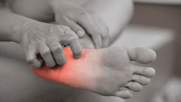 حرق القدمين: الأسباب والأعراض والتشخيص والعلاج والوقاية