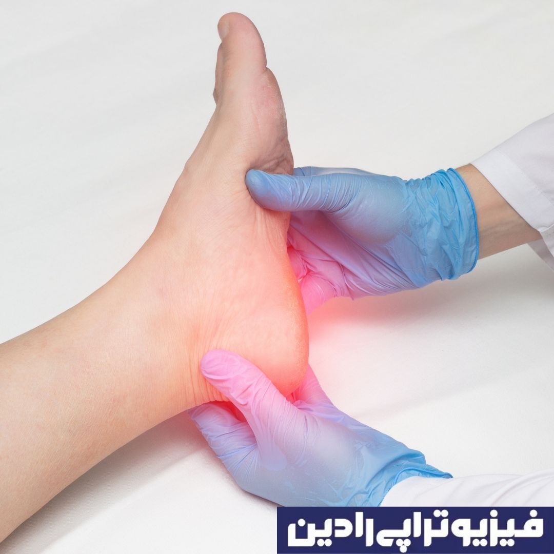 What is a heel spur? Heel spur treatment - Radin Physiotherapy Clinic