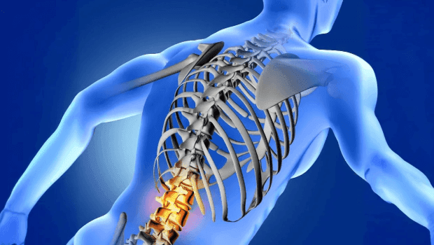 فتق القرص القطني وتشنج العضلات: التشخيص والأعراض والعلاج والوقاية