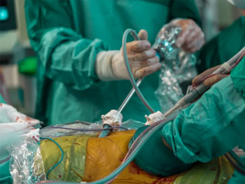 لاپاراسکوپی چیست؟ صفر تا 100