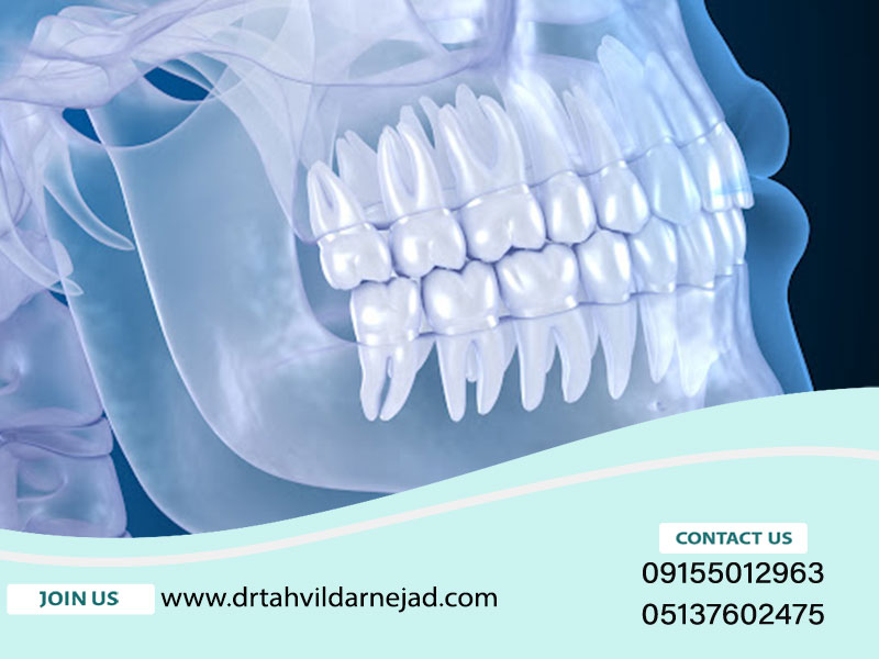What is a dental CBCT image? + review its benefits and applications Dr. Zadrudarnjad