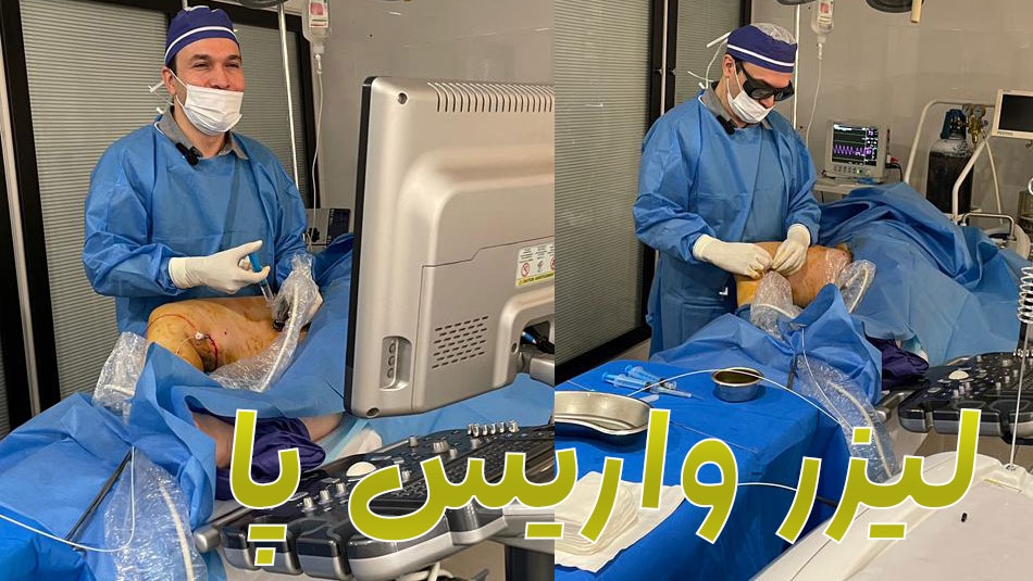 Varicose leg laser operation, immediate treatment, without pain + benefits and side effects, cost