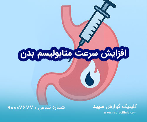 بوتاکس معده راه حلی برای فعال کردن متابولیسم بدن شماست
