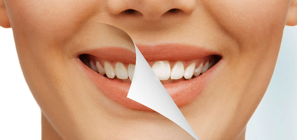 Get to know the 9 side effects of teeth bleaching!