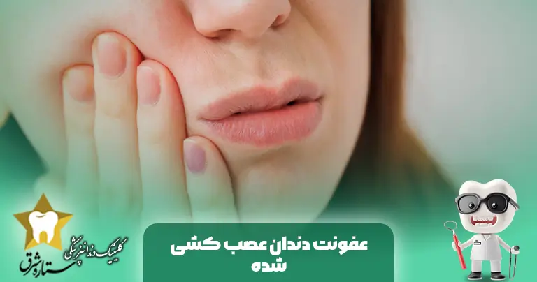 چگونه عفونت دندان عصب کشی شده را درمان کنیم؟