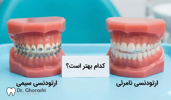 ارتودنسی سیمی بهتر است یا نامرئی؟ | کدام یک برای من مناسب است؟