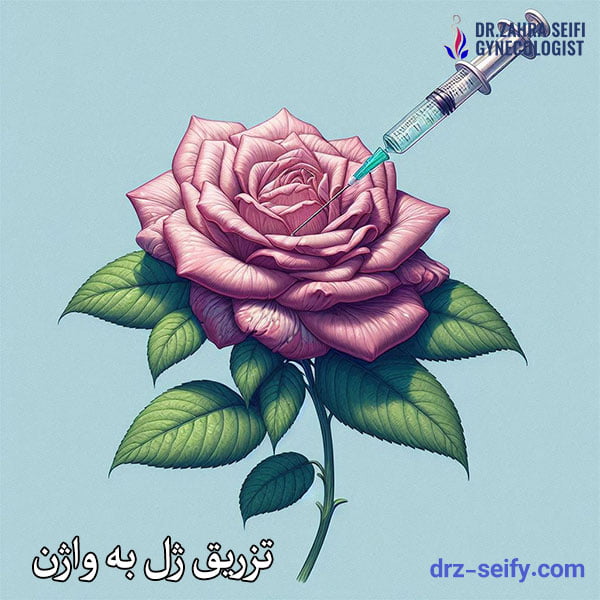 Injection of gel into the vagina Vaginal rejuvenation in Tehran Dr. Zahra Saifi