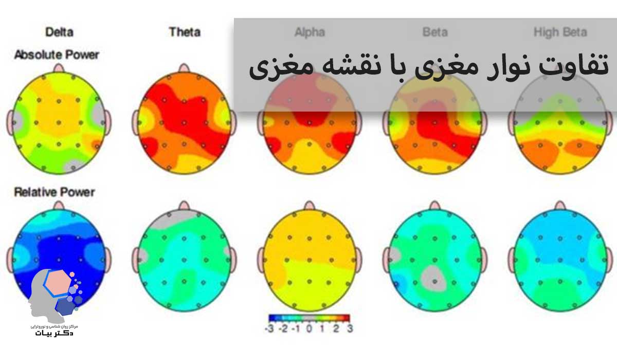 ما الفرق بين مخطط كهربية الدماغ (EEG) وخريطة الدماغ؟ مركز الدكتور بيات لعلم النفس والارتجاع العصبي