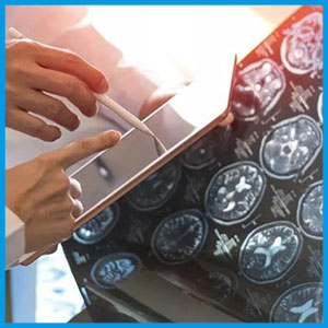 طبيب جيد لعلاج مرض التصلب العصبي المتعدد - الدكتور حميد رضا ترابي طبيب الأعصاب